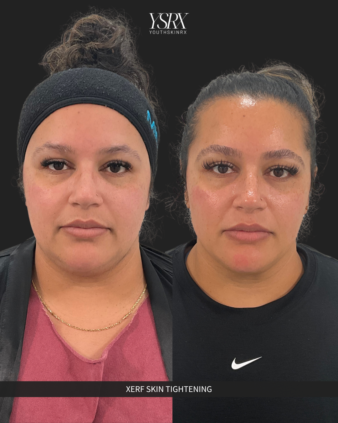 XERF Mini Package B | The Sculpt & Contour Trio 2026
