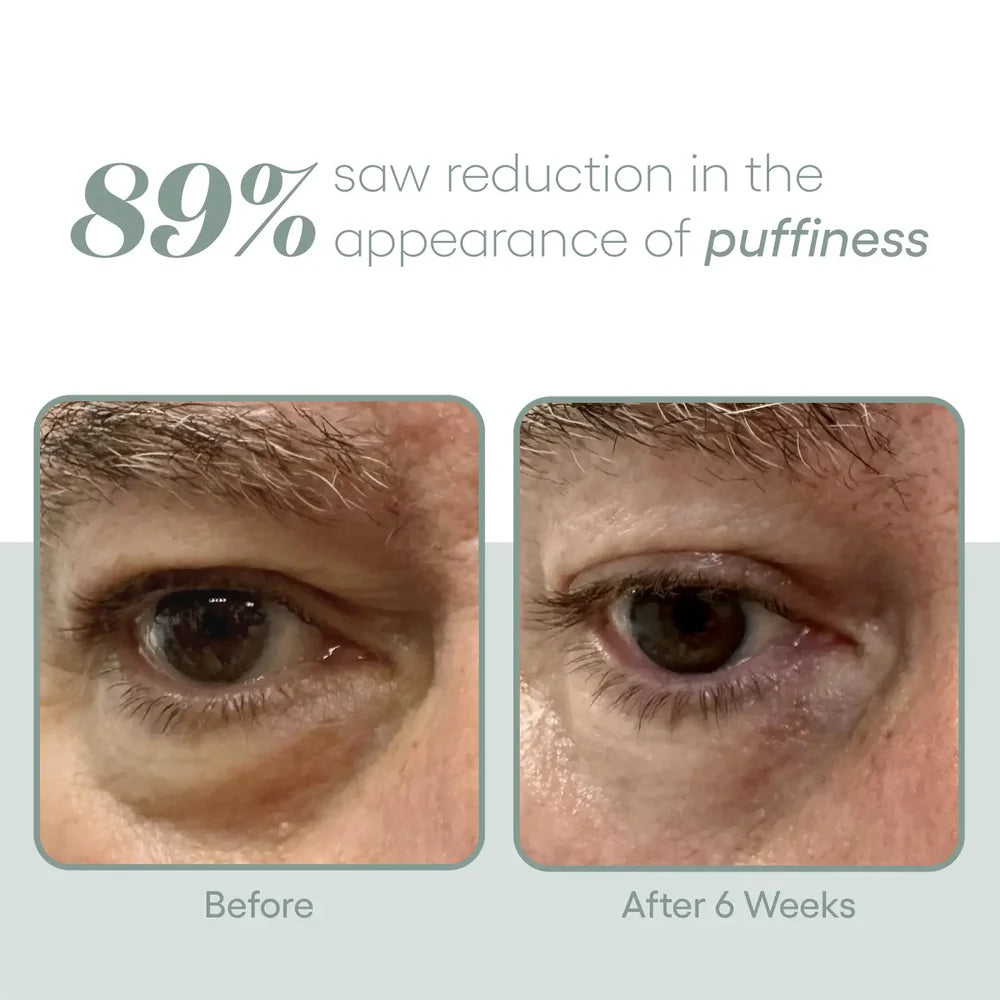 Plated Eye Serum | Advanced Renewal for Eyes | Eye Creams | Youth Skin RX Med Aesthetics, Tulsa, OK