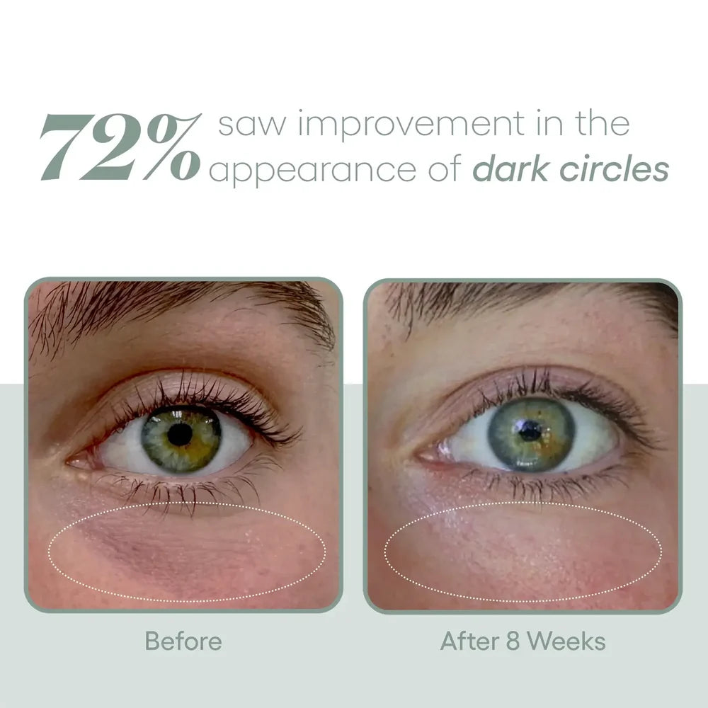 Plated Eye Serum | Advanced Renewal for Eyes | Eye Creams | Youth Skin RX Med Aesthetics, Tulsa, OK