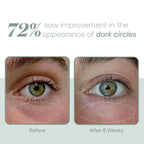 Plated Eye Serum | Advanced Renewal for Eyes | Eye Creams | Youth Skin RX Med Aesthetics, Tulsa, OK